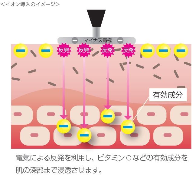 イオン導入のイメージ画像